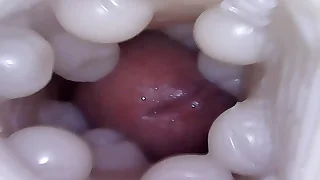 compilation